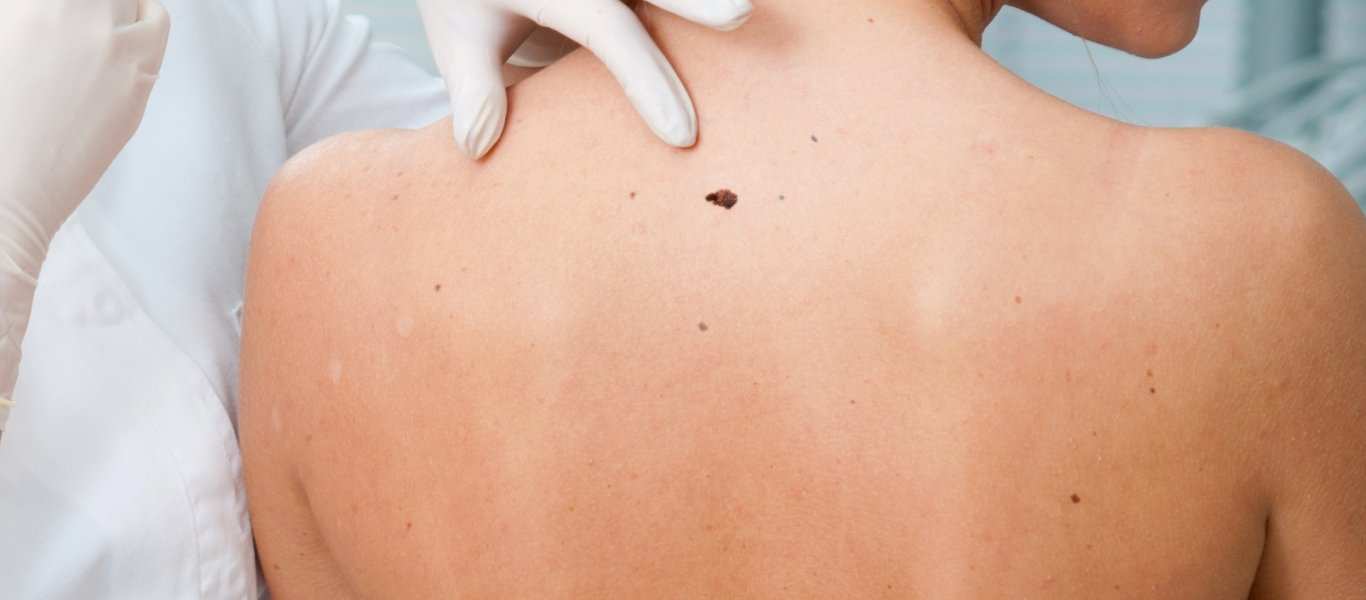 elia_derma